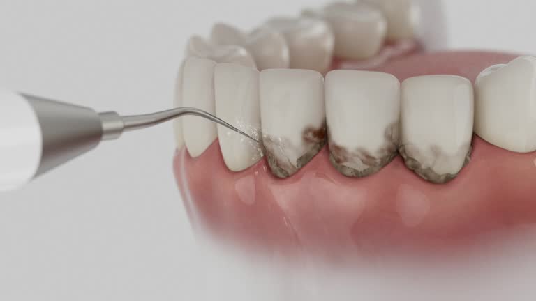Reliable Dental Implants contractor in Atchison County County, KS by Dentist Open Now